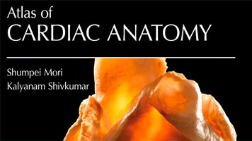 Atlas of Cardiac Anatomy