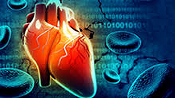 Paroxysmal supraventricular tachycardia